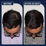 بخاخ دعم نمو الشعر AnaGain Procapil 50 مل